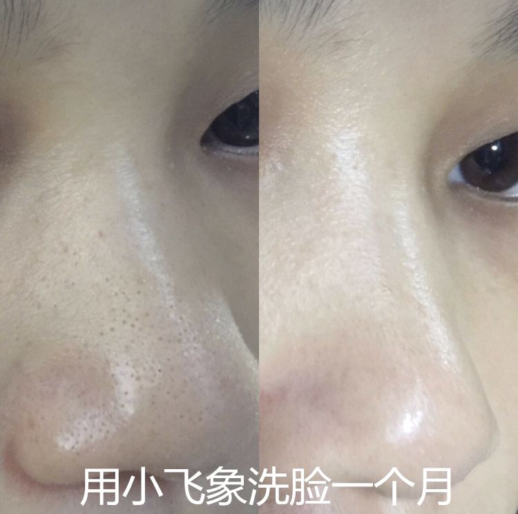 洁面仪luna同款,luna洁面仪平价替代