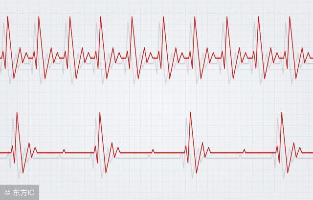 窦性心动过速和窦性心动过速区别,窦性心动过速的原因和解决方法