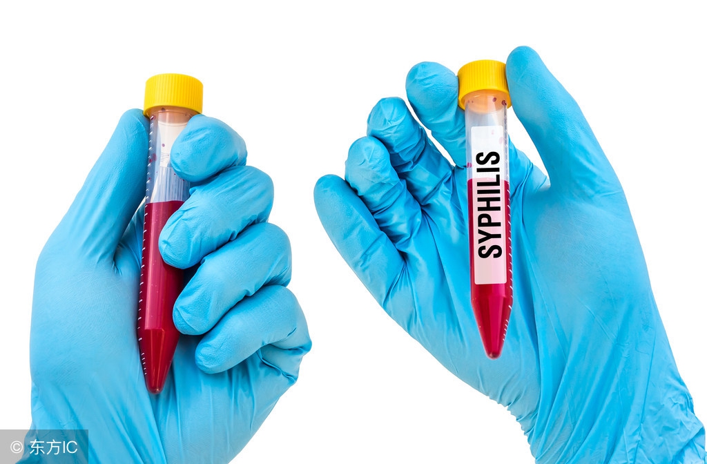 与别人握手竟染上梅毒？梅毒的感染方式有以下4种