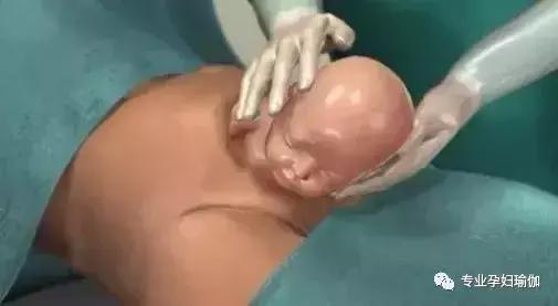 剖腹产有什么并发症吗,剖腹产后遗症要重视吗