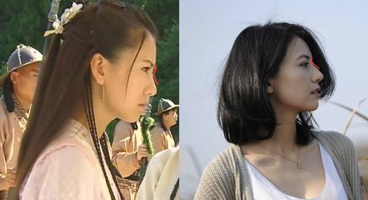 有人劝你打玻尿酸,打玻尿酸的一些常识问题