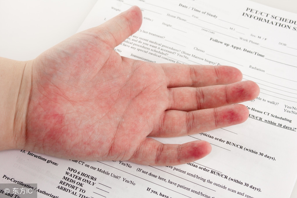 皮疹和湿疹有什么区别,皮疹和湿疹是怎么引起的