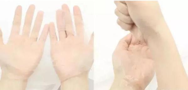 拔草品牌面膜,前几年比较火的微商面膜