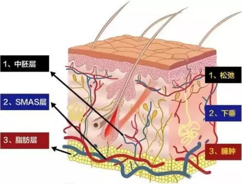你知道线雕保容颜，却不知道是否适合你？