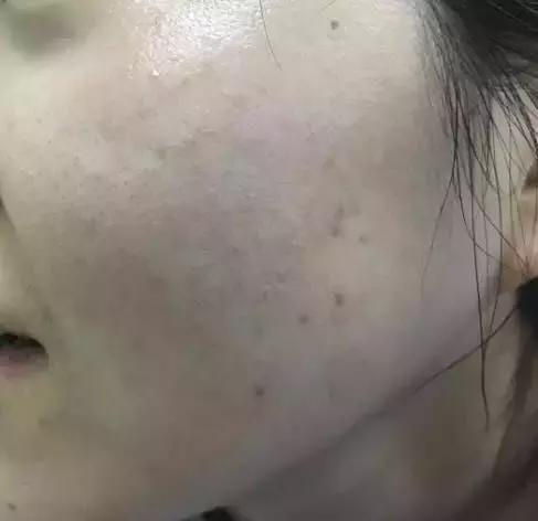 一直被国人瞧不起的老牌国货,老牌国货治好烂脸