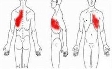 肋间神经痛怎么治疗效果最佳,肋间神经痛怎么调理