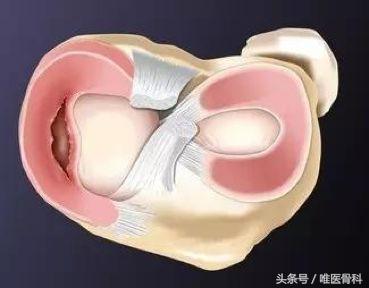 nba半月板损伤都是怎么恢复的,nba球星半月板损伤恢复比较好的