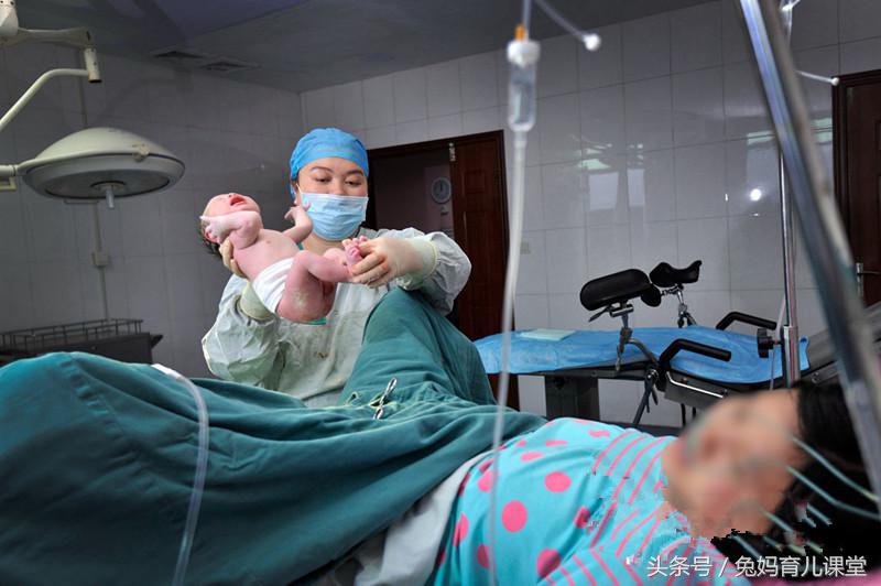 多数孕妈执意选择剖腹产,医生都会建议准妈妈选择剖腹产