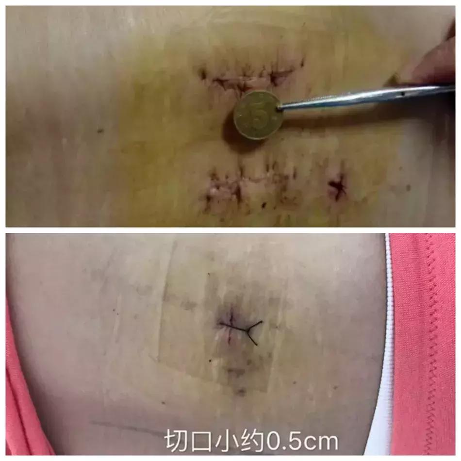 邯郸骨科医院刘芳宏,刘芳宏视频