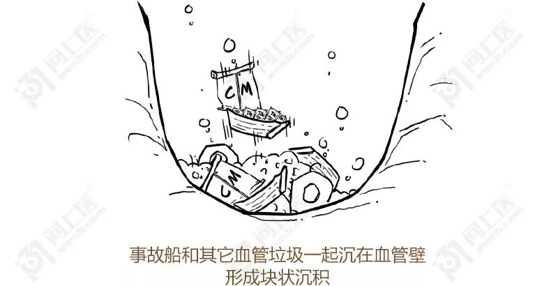 甘油三酯升高的原因动画,医学科普甘油三酯