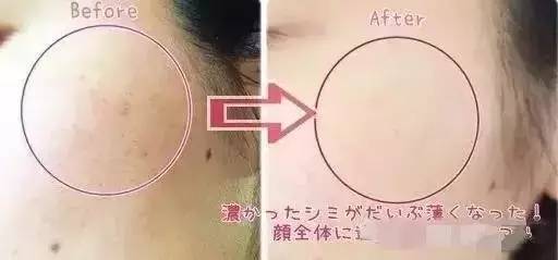 pola皮肤管理全系列,pola美白全系列