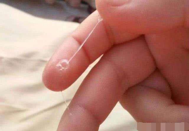 月经不准排卵期是不是也不准确了,排卵期小腹会像姨妈要来时一样