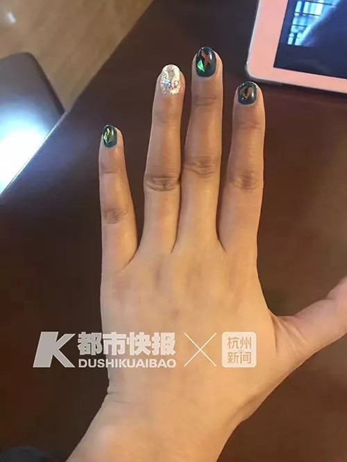 美甲手指变黑,刚做的美甲变黑了怎么办