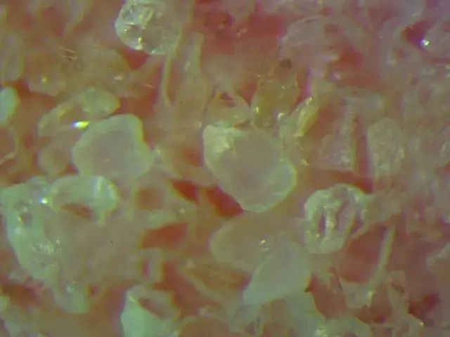 螨虫走开！中疾控检测100%有效，家有小宝、消除过敏源必备