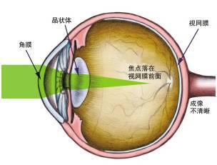 中国孩子近视率居世界首位，习*平近**总书记就此做重要指示