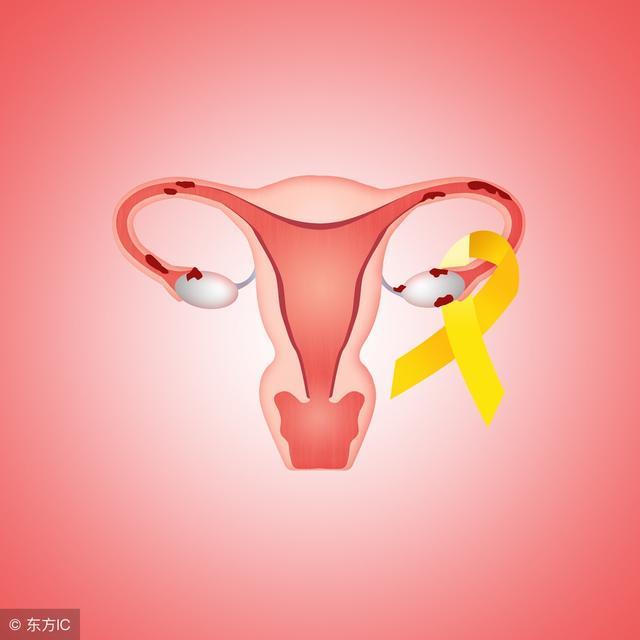 子宫内膜炎主要有以下症状,可以通过以下检查来诊断