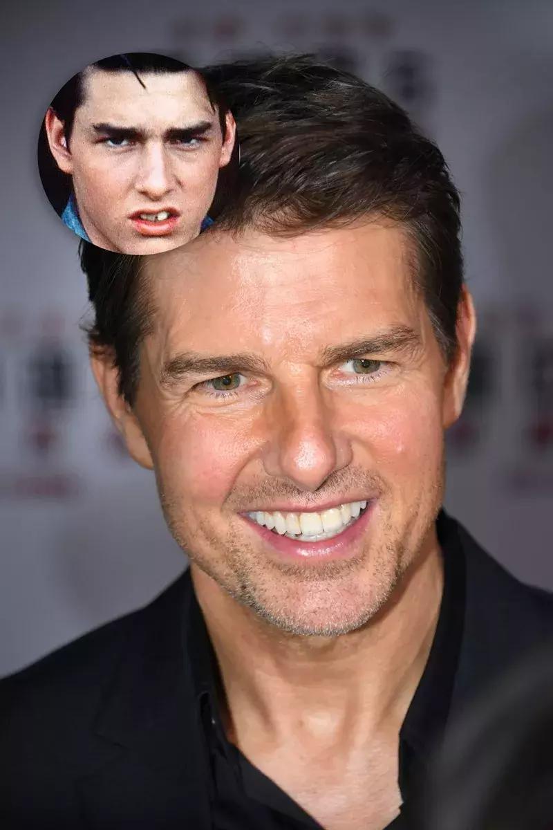 整牙后颜值明显变化的明星,明星真的会因为整牙而变漂亮了吗