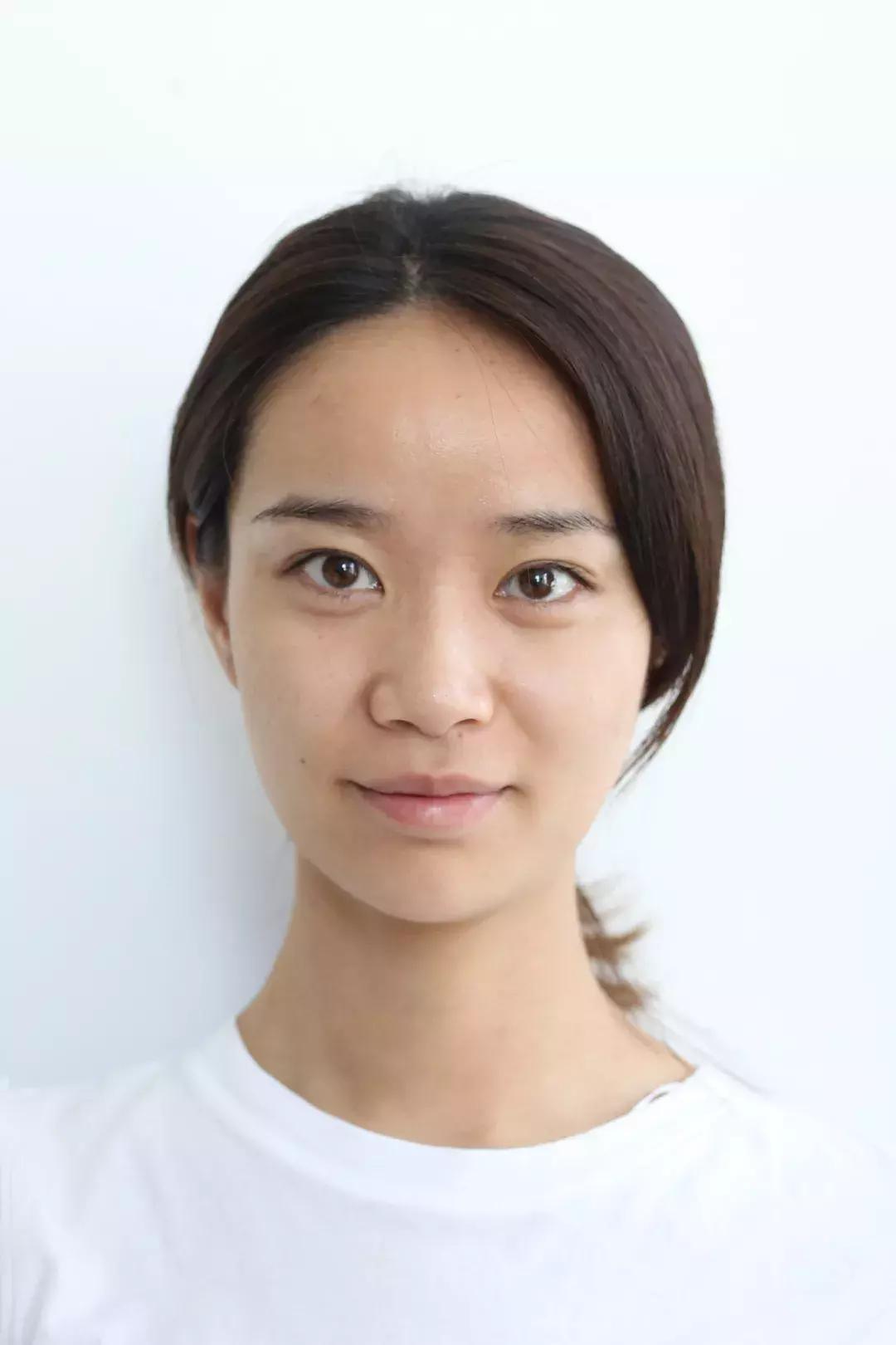 vc精华去法令纹,vc可以消除法令纹吗