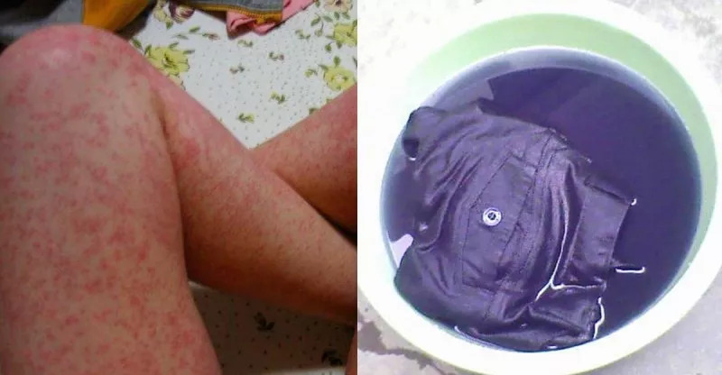 惊天黑幕！HM，ZARA等快时尚品牌的牛仔裤，已导致多*皮人**肤腐烂，恶臭，不孕...