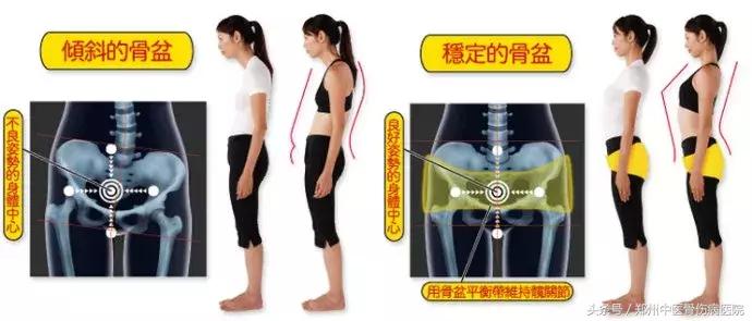 腰间盘突出要如何保养,腰间盘突出平常应该怎么保养