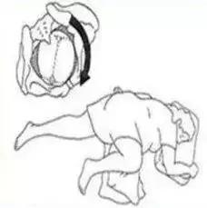 娃还能这样生?罗医首例!自由体位(侧卧位)分娩