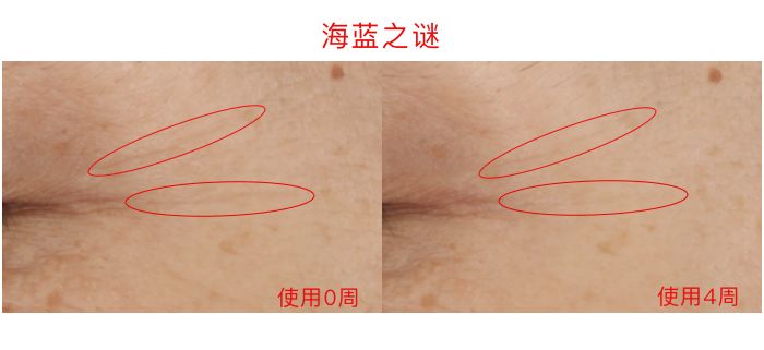 眼霜推荐lamer浓缩眼霜,lamer浓缩眼霜黑眼圈评测