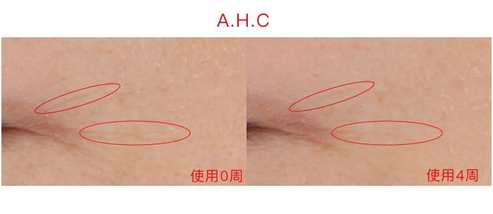 眼霜推荐lamer浓缩眼霜,lamer浓缩眼霜黑眼圈评测