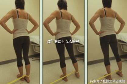 运动康复跑步膝盖疼,髂胫束摩擦综合征还能跑步吗