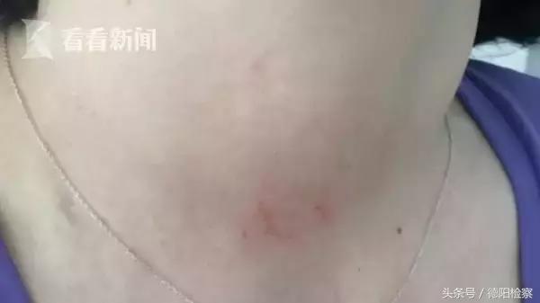 百合网相亲女子被打,百合网相亲女子被围殴