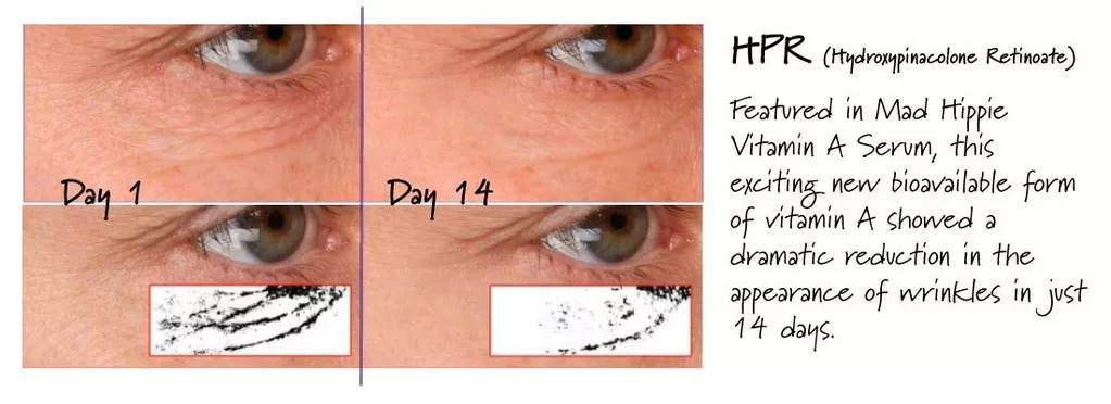 林允张雨绮,林允推荐的护肤水