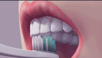 儿童长蛀牙是因为吃糖吗,孩子都有蛀牙元凶却不是糖