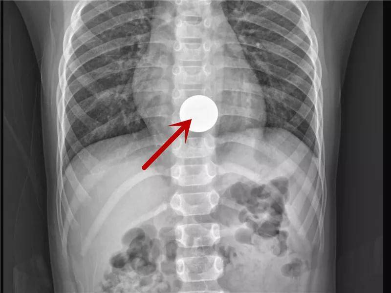 一些让人毛骨悚然拍到的照片,六个令人毛骨悚然的影像