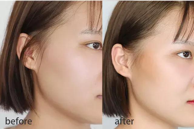 堪比整容的祛纹技巧,心机显瘦修容方法