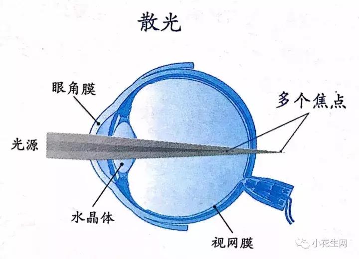 儿童近视7种早期症状,儿童近视的4大早期表现