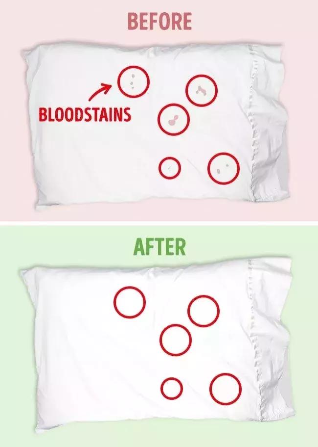 衣服发黄不要怕用它泡一泡,用漂白剂把白色衣服漂黄了怎么办