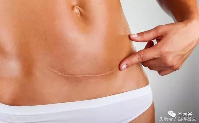 让爱没有遗憾,让爱没遗憾