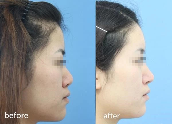 回怼键盘侠正义瞬间,怒怼键盘侠