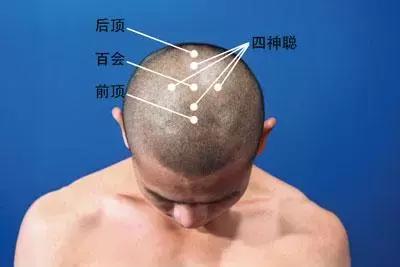 脱发尤其在换季的时候,夏末秋初脱发严重怎么回事