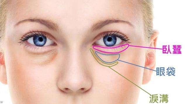 眼袋是身体哪里的问题,眼袋是哪里出问题