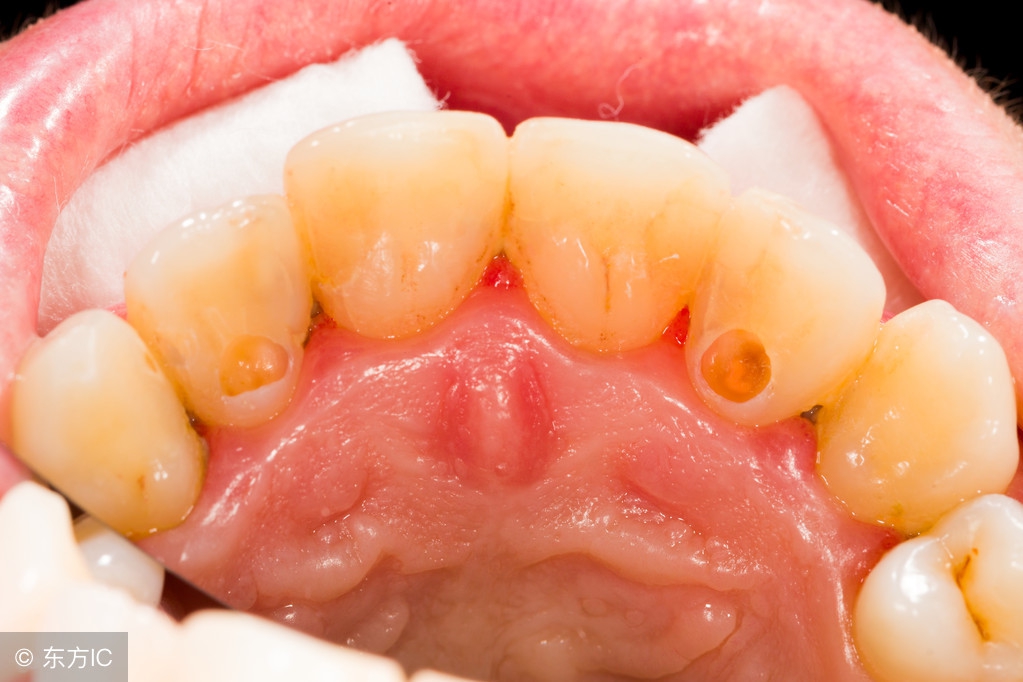 人没有了口水会怎么样,身体如果没有了口水会怎么样