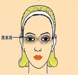 如何识别各种不同的斑,不同位置的色斑叫什么