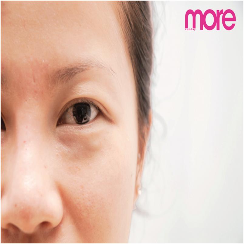 9大秘籍轻松搞定黑眼圈,有效快速解决黑眼圈的方法