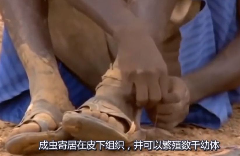 吃活物有寄生虫,吃活的虫子身体里有寄生虫