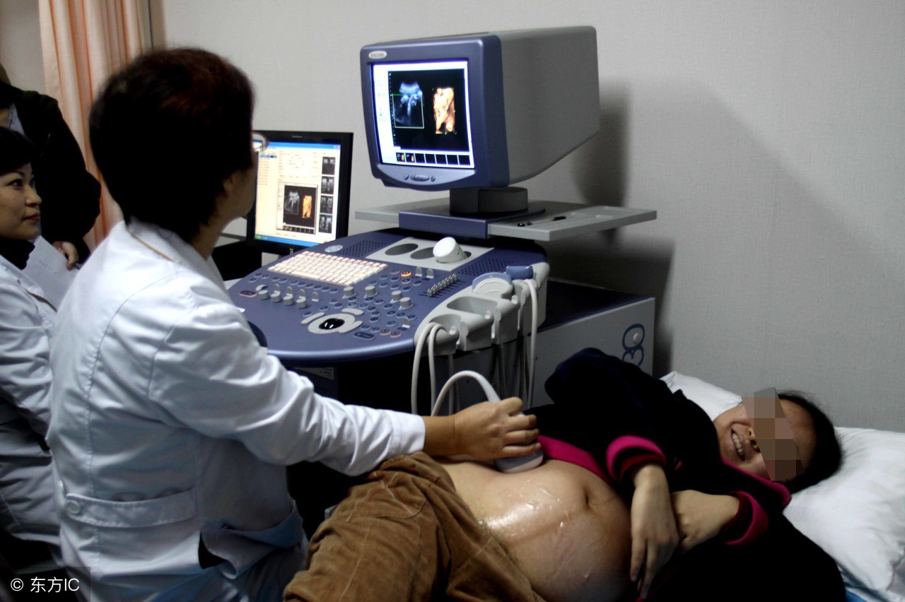 四维彩超宝宝不配合做什么动作,四维彩超宝宝不配合有什么办法