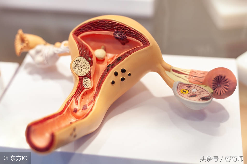 子宫切除然后长了一个息肉正常吗,子宫里长了息肉需要去掉吗