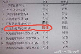 妊娠合并巨细胞病毒感染,孕期感染了巨细胞病毒有什么症状