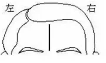 看额头皱纹命运图解,额头有皱纹代表命苦吗