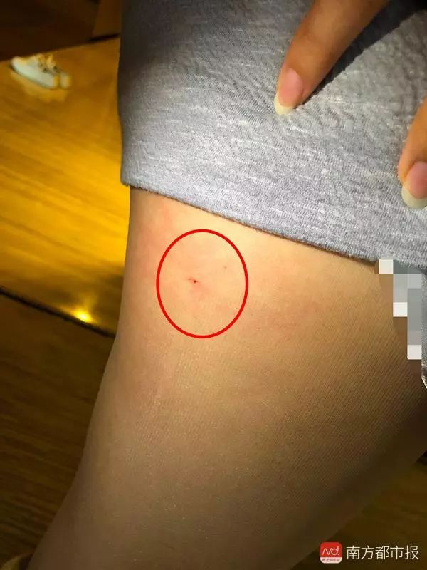 星级酒店床上有根立起的针！她大腿被扎出血！是不是被人故意藏在被褥下的？酒店：可以免除房费，风险责任不能承担！