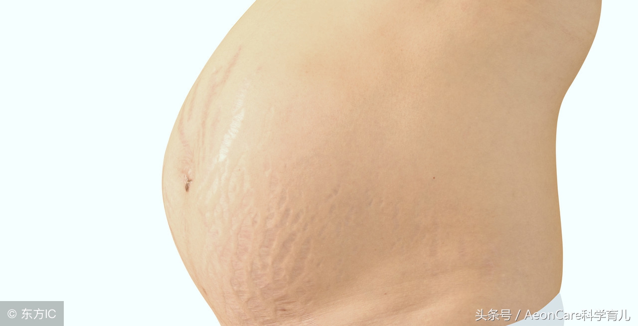 孕妈妈如何护理,不长妊娠纹?这3个方法不能少
