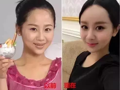 额头好看的女孩子,额头窄却漂亮的女生